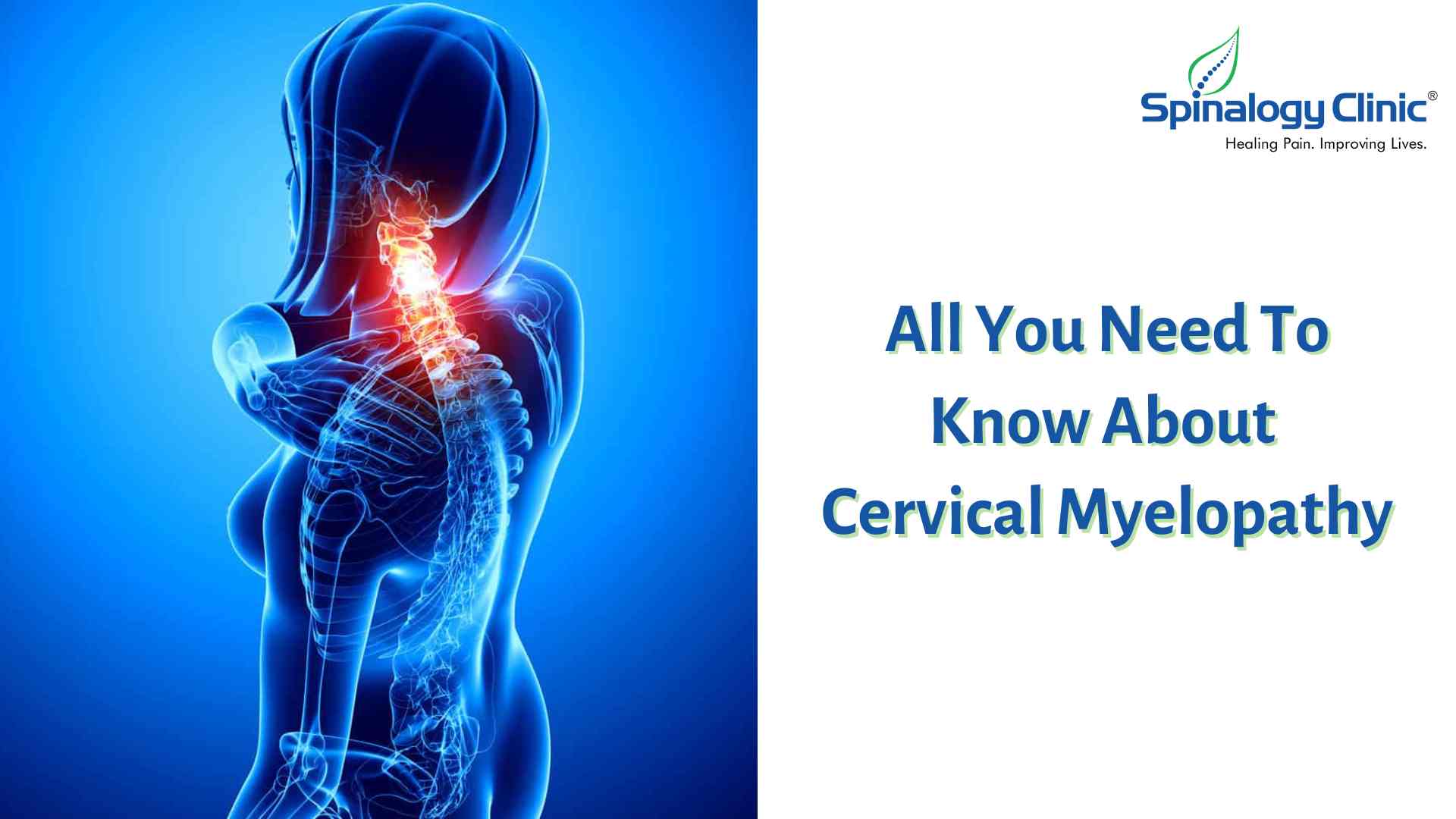 All You Need to Know About Cervical Myelopathy